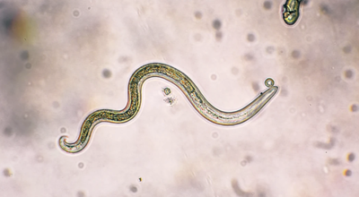 Click to see how this parasite works